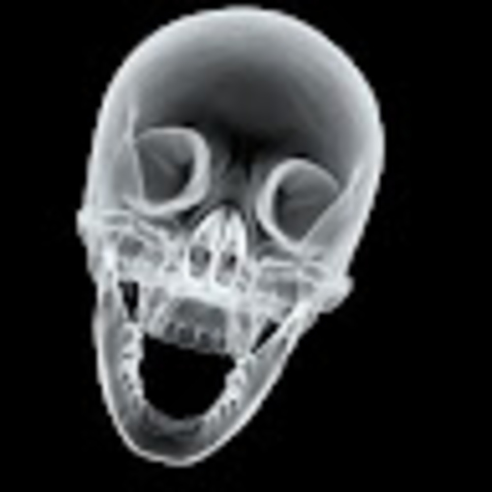 Meet your Posher, Dizzy